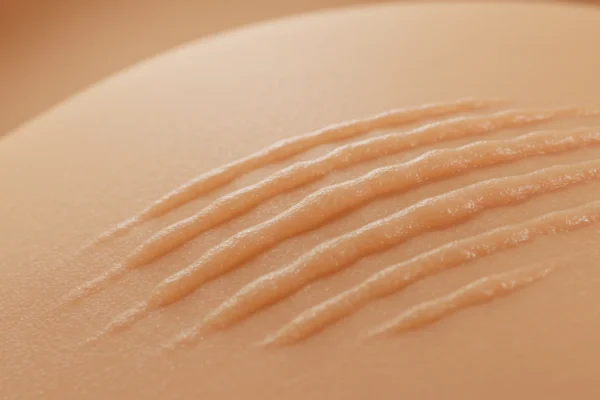 Enzyme Exfoliation: 2026’s Secret to Smooth Skin