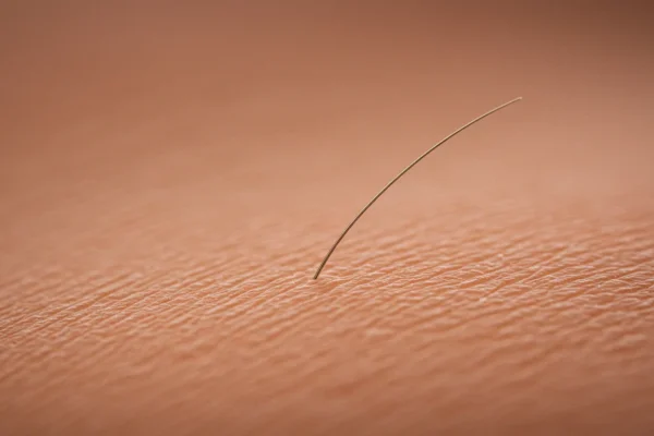Hair Removal Myths: Your Skincare in 2026