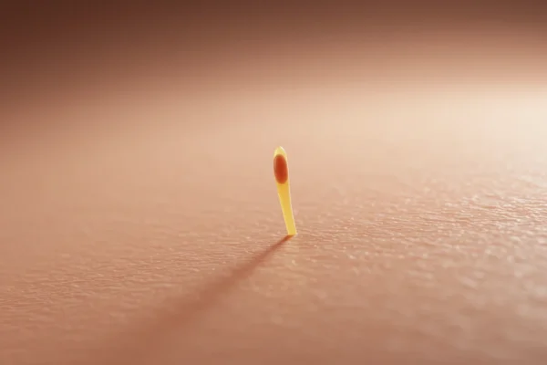 Retinoids: Ingrown Hair Breakthrough for 2026 Skin