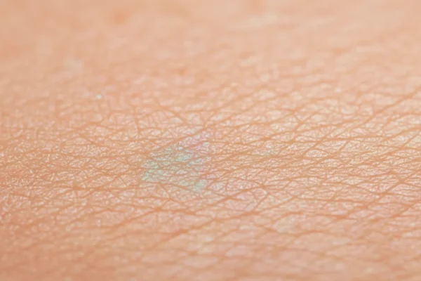 EWC TREAT: 2026 Skin Microbiome Revolution